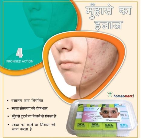 मुँहासे के इलाज के लिए होम्योपैथिक दवाएं।