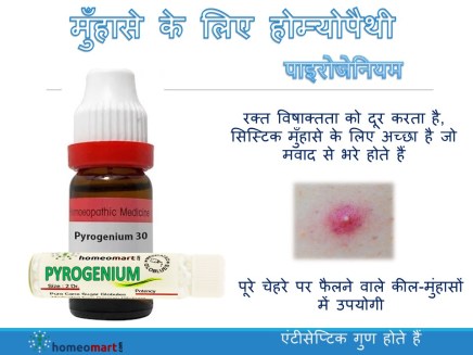 एक्ने ट्रीटमेंट इन हिंदी