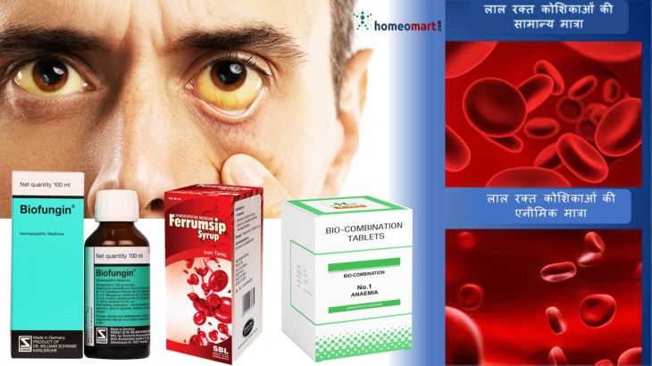 एनीमिया में क्या खाना चाहिए