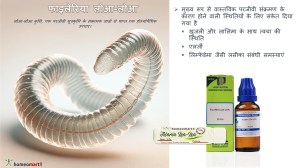 फाइलेरिया रोग उपचार