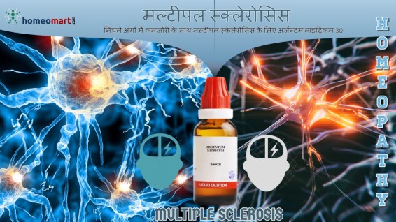 मस्तिष्क और रीढ़ की हड्डी के रोग