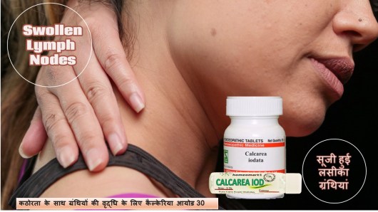 लिम्फ नोड कब तक ठीक हो जाता है