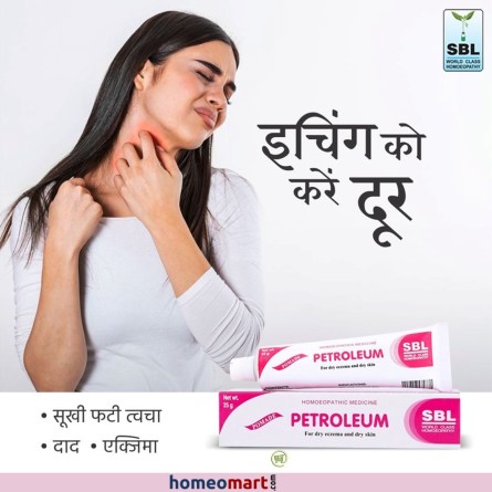 खुजली से राहत क्रीम