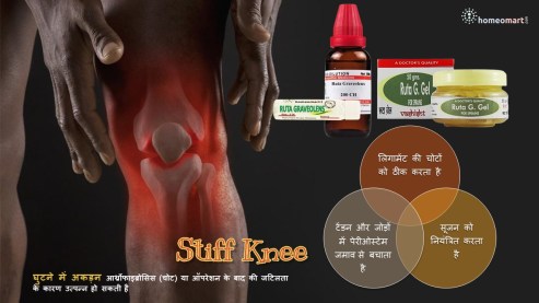 जोड़ों के दर्द की होम्योपैथी दवा