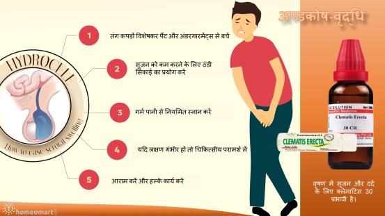 हाइड्रोसील, अण्डकोष-वृद्धि के लक्षण और होम्योपैथी में उपचार