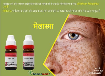  चेहरे पर मेलास्मा कैसे हटाएं?