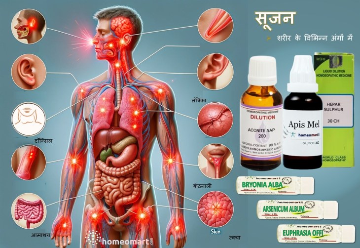 सूजन के लिए होम्योपैथी दवाएं