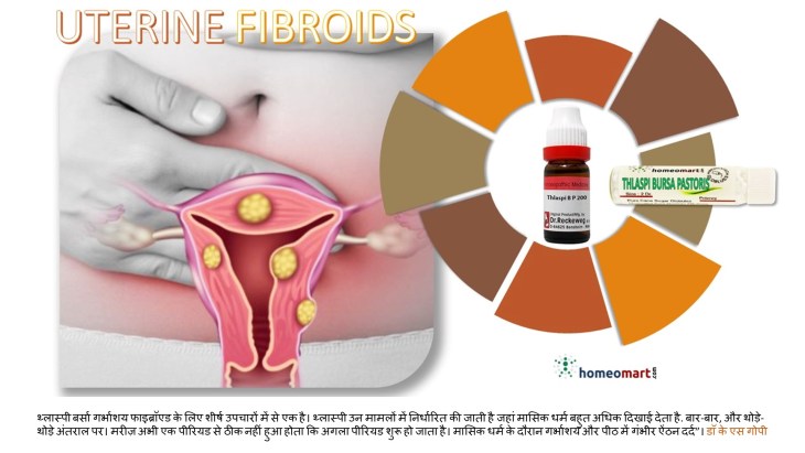 गर्भाशय फाइब्रॉएड होम्योपैथी दवा थ्लास्पी बर्सा पेक्टोरिस