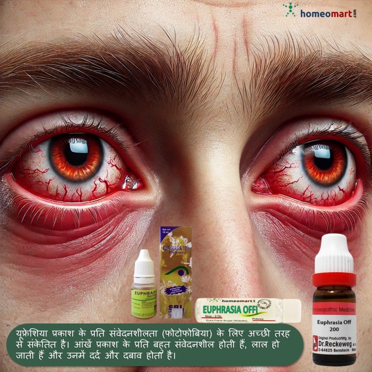 Euphrasia Officinalis (आँखज्योति) – आँखों और एलर्जी में लाभकारी होम्योपैथिक दवा