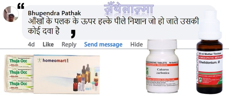 आँखों की पलकों पर पीले दाग क्यों होते हैं? Xanthelasma के कारण, टेस्ट, लक्षण और Homeopathy में Calcarea Carb, Chelidonium जैसी दवाओं के लाभ जानें।