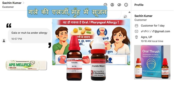  एक हिंदी इन्फोग्राफिक जिसमें गले में खुजली और मुँह में सूजन से परेशान व्यक्ति दिखाया गया है। शीर्षक में लिखा है “क्या आपके गले में खुजली या मुँह में सूजन हो रही है?” और नीचे लाल बैनर पर “यह हो सकता है Oral / Pharyngeal Allergy!”। बाईं ओर परागकण, धूल और भोजन जैसे एलर्जी के कारण दिखाए गए हैं, जबकि दाईं ओर महिला और पुरुष के चित्र हैं जो गले में दर्द और सूजन का अनुभव कर रहे हैं। नीचे तीन आइकन हैं — गले में दर्द, मुँह में जलन, और सांस लेने में कठिनाई। अंत में हरे बैनर पर लिखा है “होम्योपैथी की नजर में इसका सही इलाज संभव है।